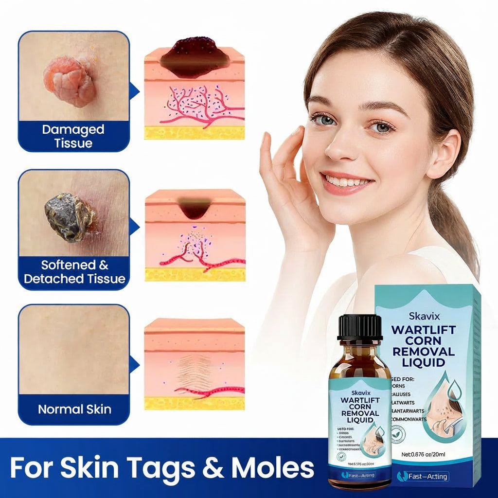 Skavix WartLift Corn Removal Liquid