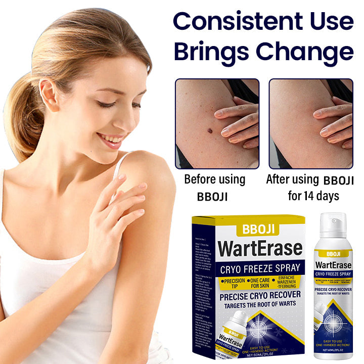 BBOJI WartErase Cryo Freeze Spray