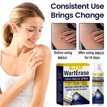 BBOJI WartErase Cryo Freeze Spray