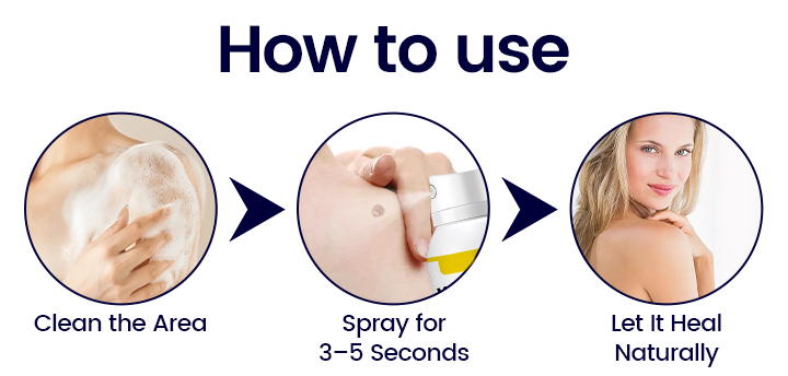 BBOJI WartErase Cryo Freeze Spray