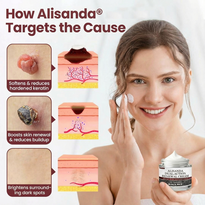 Alisanda® Dual-Action Renewal Cream– Hydrates, Renews & Smooths Skin