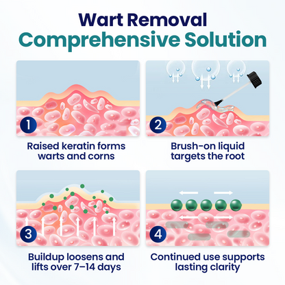 Skavix WartLift Corn Removal Liquid