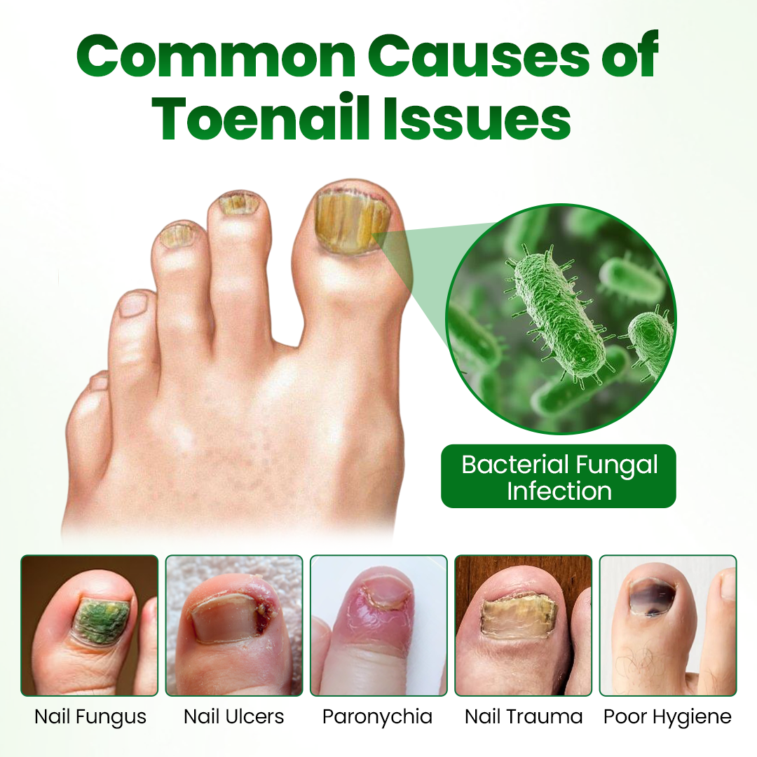 Skavix HerbaNail 7-Day Repair Serum 🔥 FDA Certified (Clinically Proven Herbal Formula for 7-Day Nail Fungus Repair & Strength Restoration 🌿)