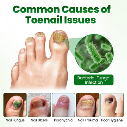 Skavix HerbaNail 7-Day Repair Serum 🔥 FDA Certified (Clinically Proven Herbal Formula for 7-Day Nail Fungus Repair & Strength Restoration 🌿)