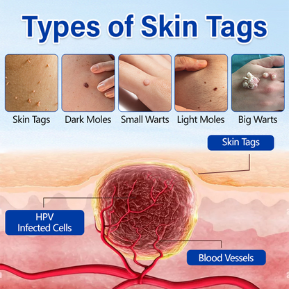 Taileden WartClear Herbal Ointment