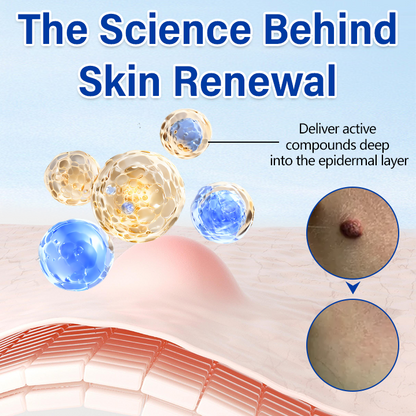 Taileden WartClear Herbal Ointment