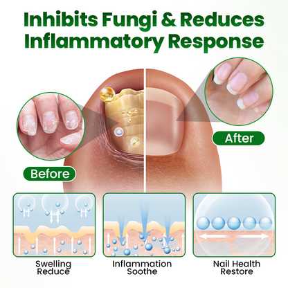 Skavix HerbaNail 7-Day Repair Serum 🔥 FDA Certified (Clinically Proven Herbal Formula for 7-Day Nail Fungus Repair & Strength Restoration 🌿)