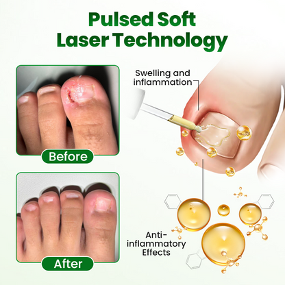 Skavix HerbaNail 7-Day Repair Serum 🔥 FDA Certified (Clinically Proven Herbal Formula for 7-Day Nail Fungus Repair & Strength Restoration 🌿)